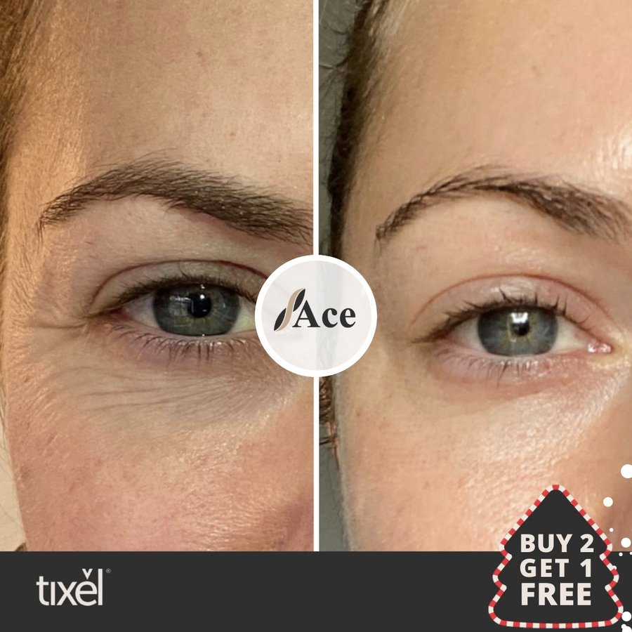 Ace Aesthetics - Ace Aesthetics